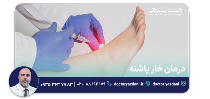 درمان خار پاشنه